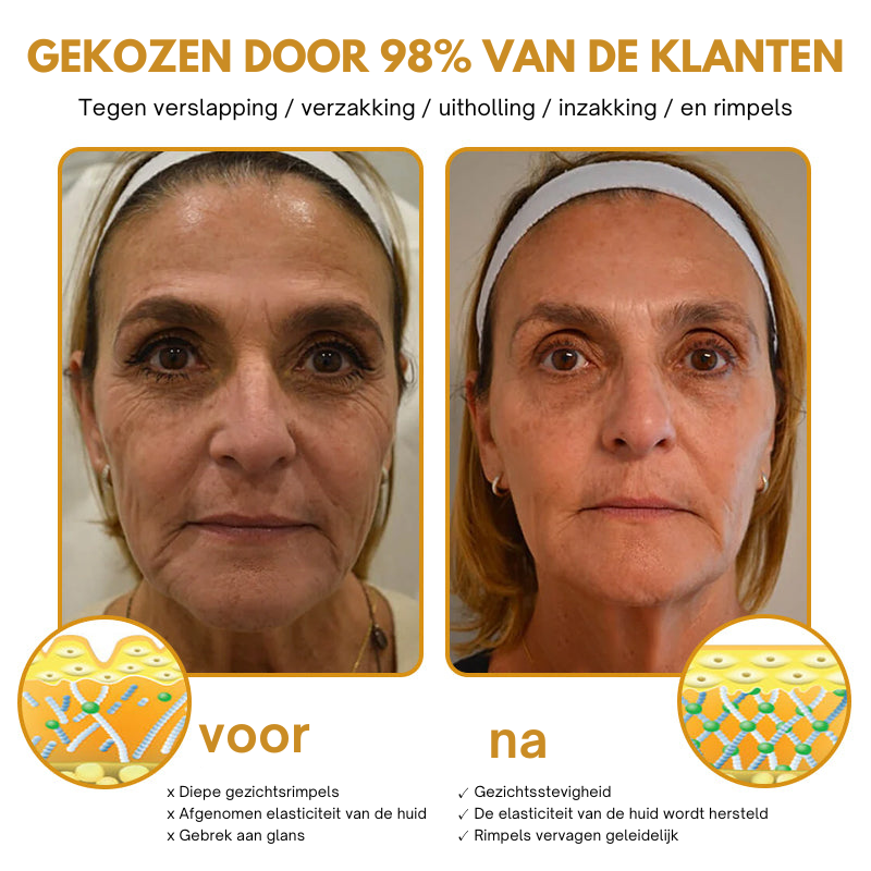 Anti-Wrinkle™ | Botox Rimpelverwijdering Crème | 1+1 gratis